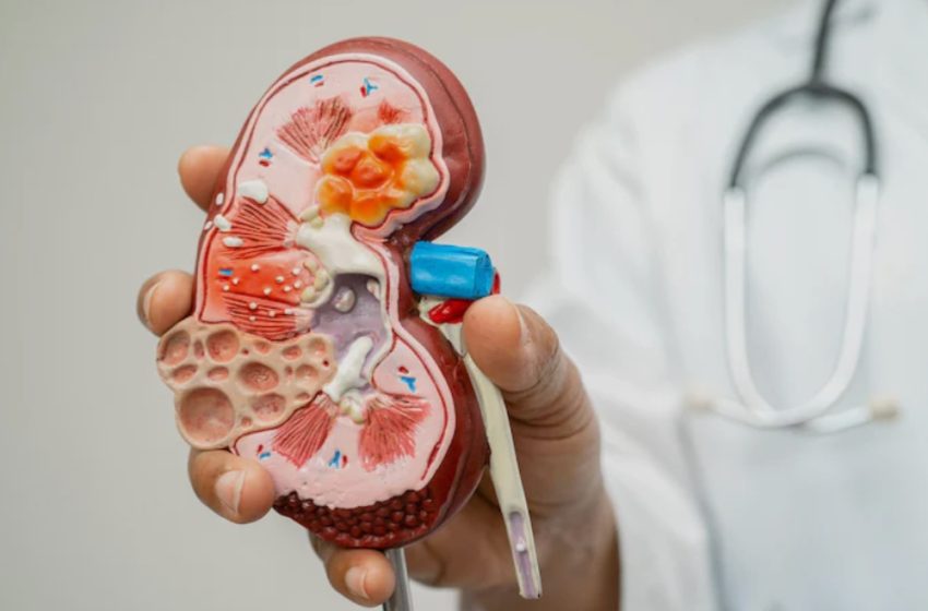 Estudo alerta para subdiagnóstico da doença renal crônica no Brasil